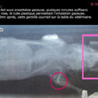 Radiographie sous anesthsie gazeuse